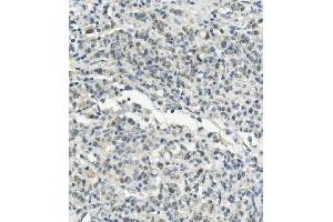 IHC analysis of UBE3A using anti-UBE3A antibody (ABIN7599562). (ube3a Antikörper  (AA 1-860))