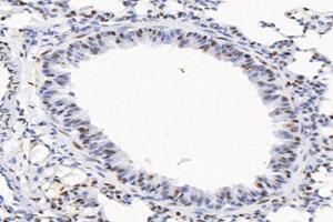 Immunohistochemistry analysis of paraffin-embedded mouse lung using,SET (ABIN7075583) at dilution of 1: 10000 (SET/TAF-I Antikörper)