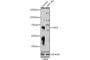 Western blot analysis of extracts from normal (control) and Y Rabbit pAb knockout (KO) HeLa cells, using Y Rabbit pAb antibody (ABIN6132788, ABIN6150316, ABIN6150321 and ABIN6215135) at 1:1000 dilution. (YAP1 Antikörper  (AA 155-504))