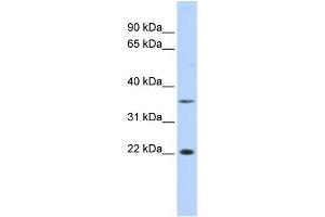 WB Suggested Anti-C16orf80 Antibody Titration:  0. (C16orf80 Antikörper  (Middle Region))