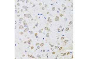 Immunohistochemistry of paraffin-embedded mouse brain using ARL6 antibody at dilution of 1:100 (x40 lens). (ARL6 Antikörper)