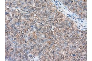 Immunohistochemical staining of paraffin-embedded Human liver tissue using anti-RANGAP1 mouse monoclonal antibody.