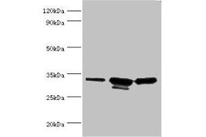 Western blot All lanes: CAPZB antibody at 6 μg/mL Lane 1: 293T whole cell lysate Lane 2: A431 whole cell lysate Lane 3: Jurkat whole cell lysate Secondary Goat polyclonal to rabbit IgG at 1/10000 dilution Predicted band size: 32, 31 kDa Observed band size: 32, 31 kDa (CAPZB Antikörper  (AA 1-272))