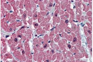 Human Heart: Formalin-Fixed, Paraffin-Embedded (FFPE) (TNNC1 Antikörper  (AA 1-162))