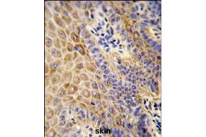 Formalin-fixed and paraffin-embedded human Skin reacted with GC Antibody , which was peroxidase-conjugated to the secondary antibody, followed by DAB staining. (Gc (AA 337-365) Antikörper)