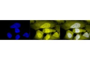 Immunocytochemistry/Immunofluorescence analysis using Rabbit Anti-Phosphoserine Polyclonal Antibody (ABIN361725).