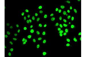 Immunofluorescence analysis of MCF7 cell using REST antibody. (REST Antikörper)