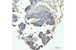 IHC analysis of GRPEL1 using anti-GRPEL1 antibody (ABIN7602643).