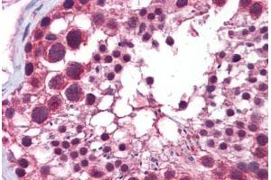 Human Testis: Formalin-Fixed, Paraffin-Embedded (FFPE) (HDAC6 Antikörper  (N-Term))