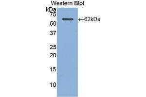 Detection of Recombinant CTSA, Human using Polyclonal Antibody to Cathepsin A (CTSA) (CTSA Antikörper  (AA 215-470))
