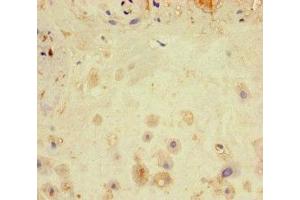 Immunohistochemistry of paraffin-embedded human placenta tissue using ABIN7169059 at dilution of 1:100 (LATS1 Antikörper  (AA 1-280))