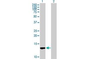 Western Blot analysis of CD59 expression in transfected 293T cell line by CD59 MaxPab polyclonal antibody. (CD59 Antikörper  (AA 1-128))