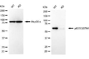 Western blotting analysis using p62/SQSTM1 antibody (ABIN7800298).
