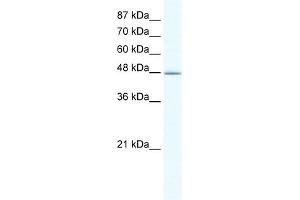 WB Suggested Anti-DMAP1 Antibody Titration:  1. (DMAP1 Antikörper  (N-Term))