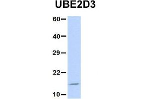 Host:  Rabbit  Target Name:  UBE2D3  Sample Type:  Jurkat  Antibody Dilution:  1. (UBE2D3 Antikörper  (N-Term))