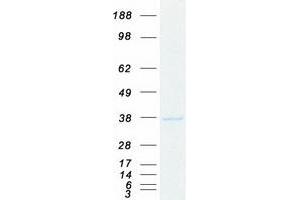 Western Blotting (WB) image for Poly(rC) Binding Protein 1 (PCBP1) protein (Myc-DYKDDDDK Tag) (ABIN2728351)