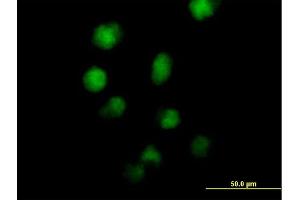 Immunofluorescence of purified MaxPab antibody to ZNF42 on HeLa cell.