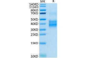 Human NKG2A/CD159a on Tris-Bis PAGE under reduced condition. (KLRC1 Protein (His-Avi Tag))