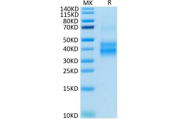 KLRC1 Protein (His-Avi Tag)
