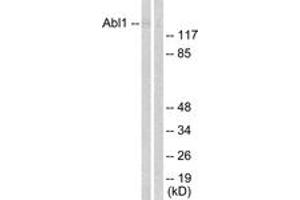 Western blot analysis of extracts from COS7 cells, treated with Adriamycin 0. (ABL1 Antikörper  (AA 156-205))