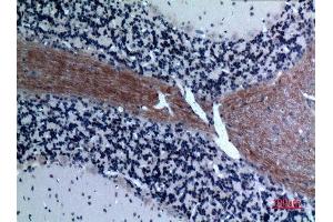 Immunohistochemistry (IHC) analysis of paraffin-embedded Rat Brain, antibody was diluted at 1:100. (CCL26 Antikörper  (Internal Region))