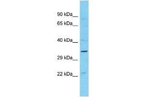 Western Blotting (WB) image for anti-Melanoma Antigen Family B, 10 (MAGEB10) (N-Term) antibody (ABIN2791656) (MAGEB10 Antikörper  (N-Term))