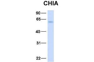 Host:  Rabbit  Target Name:  CHIA  Sample Type:  Human Fetal Liver  Antibody Dilution:  1. (CHIA Antikörper  (N-Term))