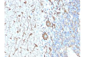 Formalin-fixed, paraffin-embedded human Cerebellum stained with Neurofilament Rabbit Recombinant Monoclonal Antibody (NEFL. (Rekombinanter NEFH Antikörper)