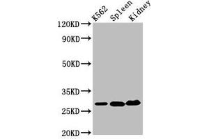 Western Blot Positive WB detected in: K562 whole cell lysate, Mouse spleen tissue, Mouse kidney tissue All lanes: CA1 antibody at 6. (CA1 Antikörper  (AA 2-261))