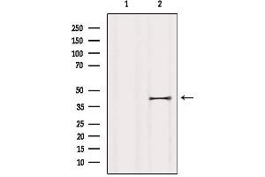 Western blot analysis of extracts from HUVEC, using P2RY5 Antibody. (LPAR6 Antikörper  (Internal Region))