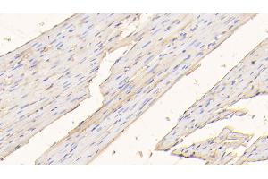 Detection of ALB in Rat Cardiac Muscle Tissue using Polyclonal Antibody to Albumin (ALB) (Albumin Antikörper)