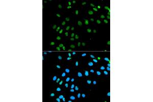 Immunofluorescence analysis of MCF7 cell using MNAT1 antibody. (MNAT1 Antikörper)