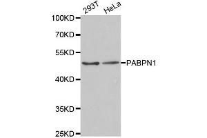 Western Blotting (WB) image for anti-Poly A Binding Protein Nuclear 1 (PABPN1) antibody (ABIN1877070) (PABPN1 Antikörper)