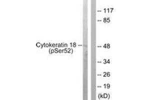Western blot analysis of extracts from HepG2 cells, using Keratin 18 (Phospho-Ser52) Antibody. (Cytokeratin 18 Antikörper  (pSer52))