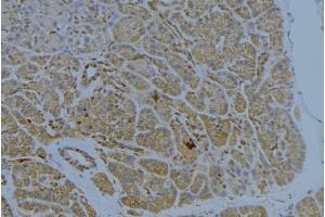 ABIN6272341 at 1/100 staining Human pancreas tissue by IHC-P. (ST14 Antikörper  (Internal Region))