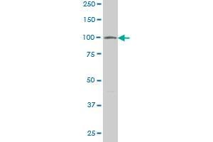 VPS18 monoclonal antibody (M02), clone 2G10. (VPS18 Antikörper  (AA 3-100))