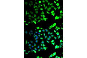 Immunofluorescence analysis of HeLa cell using XIAP antibody. (XIAP Antikörper)