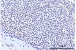 IHC analysis of RBM22 using anti-RBM22 antibody (ABIN7600268). (RBM22 Antikörper  (AA 17-406))