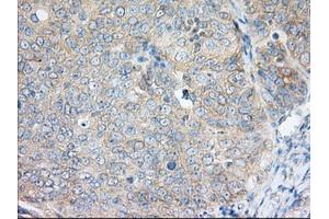 Immunohistochemical staining of paraffin-embedded Human liver tissue using anti-H6PD mouse monoclonal antibody. (Glucose-6-Phosphate Dehydrogenase Antikörper)