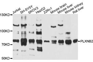 Western blot analysis of extracts of various cells, using PLXNB2 antibody. (Plexin B2 Antikörper)