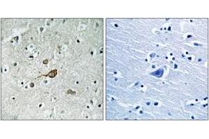 Immunohistochemistry analysis of paraffin-embedded human brain tissue, using c-Abl (Ab-412) Antibody. (ABL1 Antikörper  (AA 406-455))