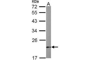 WB Image Sample (50 ug of whole cell lysate) A: mouse stomach 12% SDS PAGE antibody diluted at 1:1000 (Dual Specificity Phosphatase 3 (DUSP3) Antikörper)