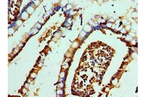 Immunohistochemistry of paraffin-embedded human small intestine tissue using ABIN7161506 at dilution of 1:100 (alpha Defensin 1 Antikörper  (AA 1-94))