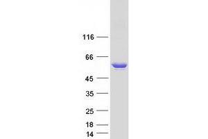 Validation with Western Blot (GAD65 Protein (Transcript Variant 2) (Myc-DYKDDDDK Tag))