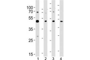 Western Blotting (WB) image for anti-Suppressor of Variegation 3-9 Homolog 2 (Drosophila) (SUV39H2) (AA 360-390) antibody (ABIN3029054)