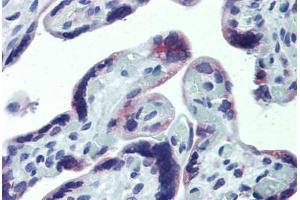Anti-CXCR6 antibody IHC staining of human placenta. (CXCR6 Antikörper  (AA 82-142))