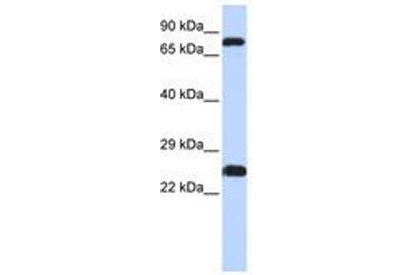 ZNF799 anticorps  (AA 111-160)