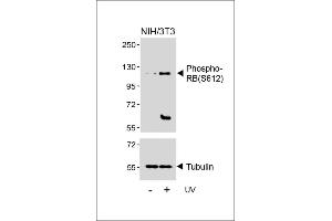 Western blot analysis of lysates from NIH/3T3 cell line, untreated or treated with UV(2h), using Phospho-RB Antibody (upper) or Tubulin (lower). (Retinoblastoma 1 Antikörper  (pSer612))