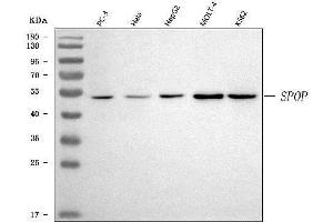 Western blot analysis of SPOP using anti-SPOP antibody (ABIN7603237).