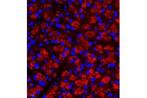 Immunofluorescence of paraffin embedded rat pancreas using Rac3 (ABIN7075378) at dilution of 1:500 (400x lens) (RAC3 Antikörper)